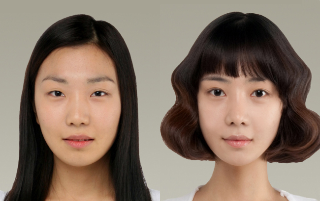 假体隆鼻恢复期多久